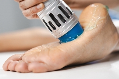 Illustration of Shockwave therapy